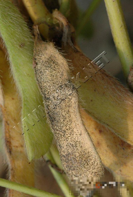 大豆荚枯病